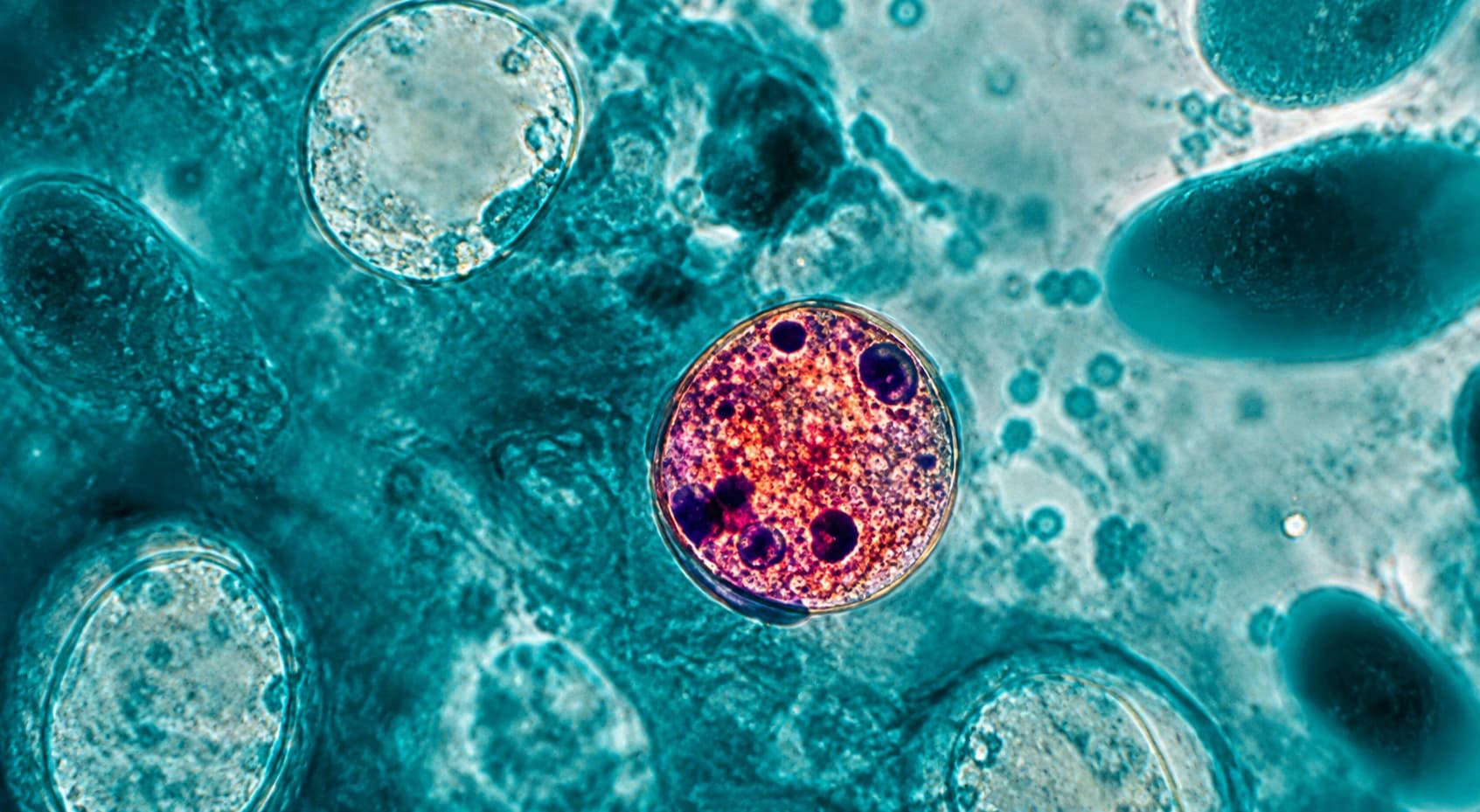 Health Officials Monitor Rising Intestinal Parasite Cases Across the US